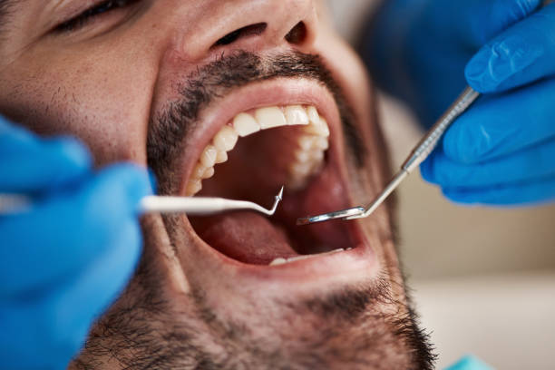 Best Urgent Dental Care for Toothache in Leonia, NJ